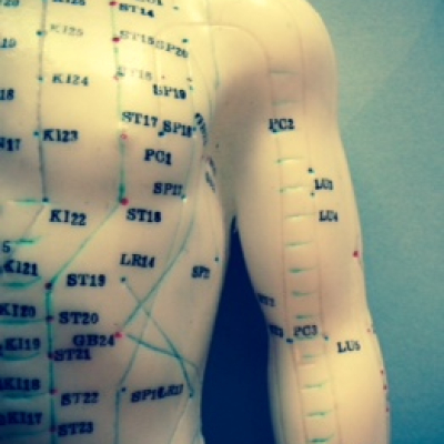 Acupuncture is safer than over the counter pain-killers