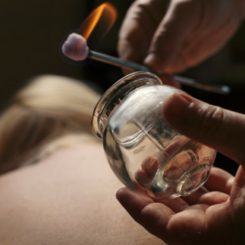 Cupping